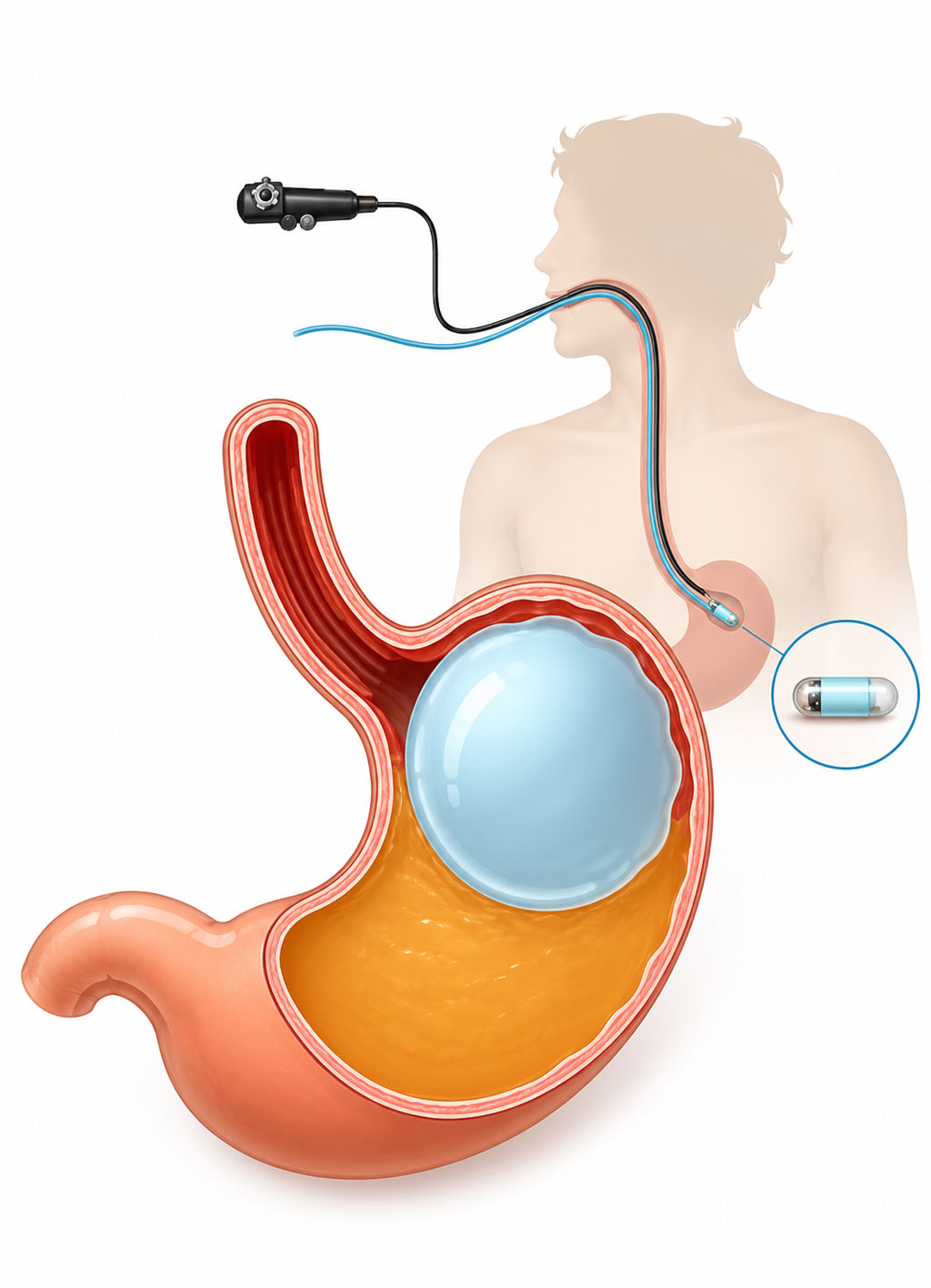 Enteroscopy